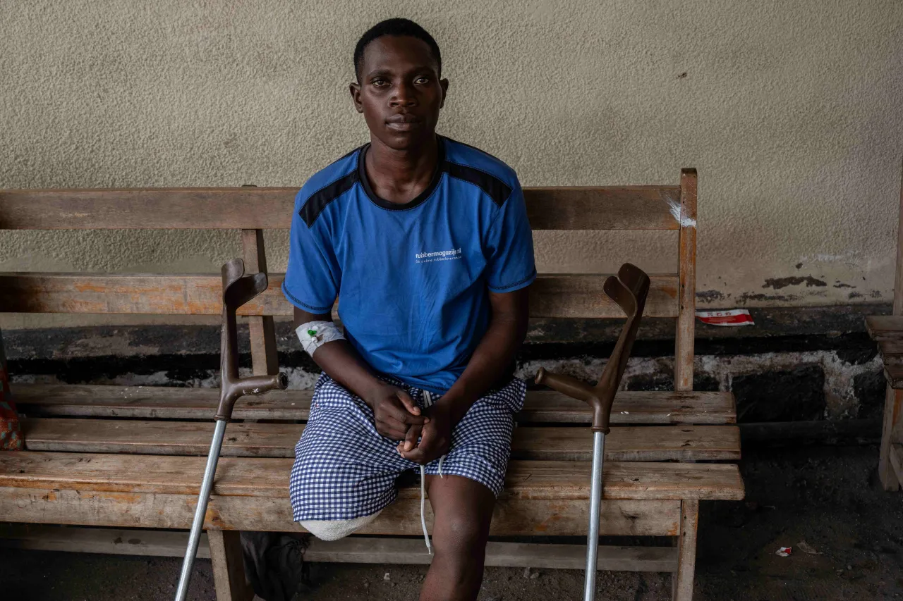 Elia Habimana, 25, had his leg amputated following a serious injury. Elia Habimana, 25, had his leg amputated following a serious injury.