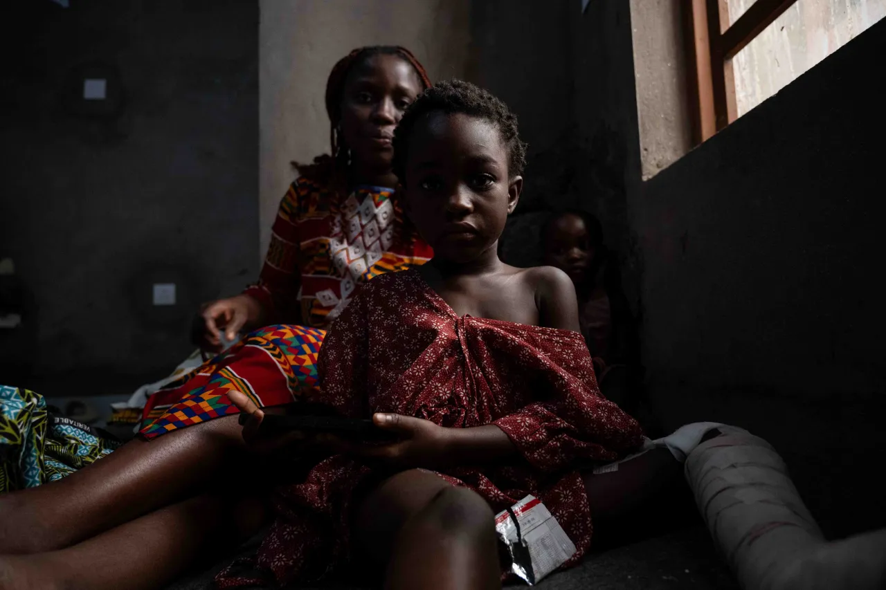 Kashindi Mariam is the sick nurse of her daughter who was hit in the leg by shrapnel from an explosive device. Kashindi Mariam is the sick nurse of her daughter who was hit in the leg by shrapnel from an explosive device.