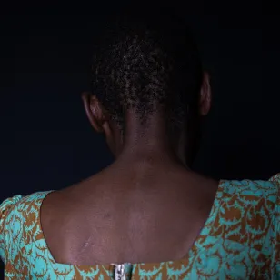 Odette, survivor of sexual violence in the DRC.