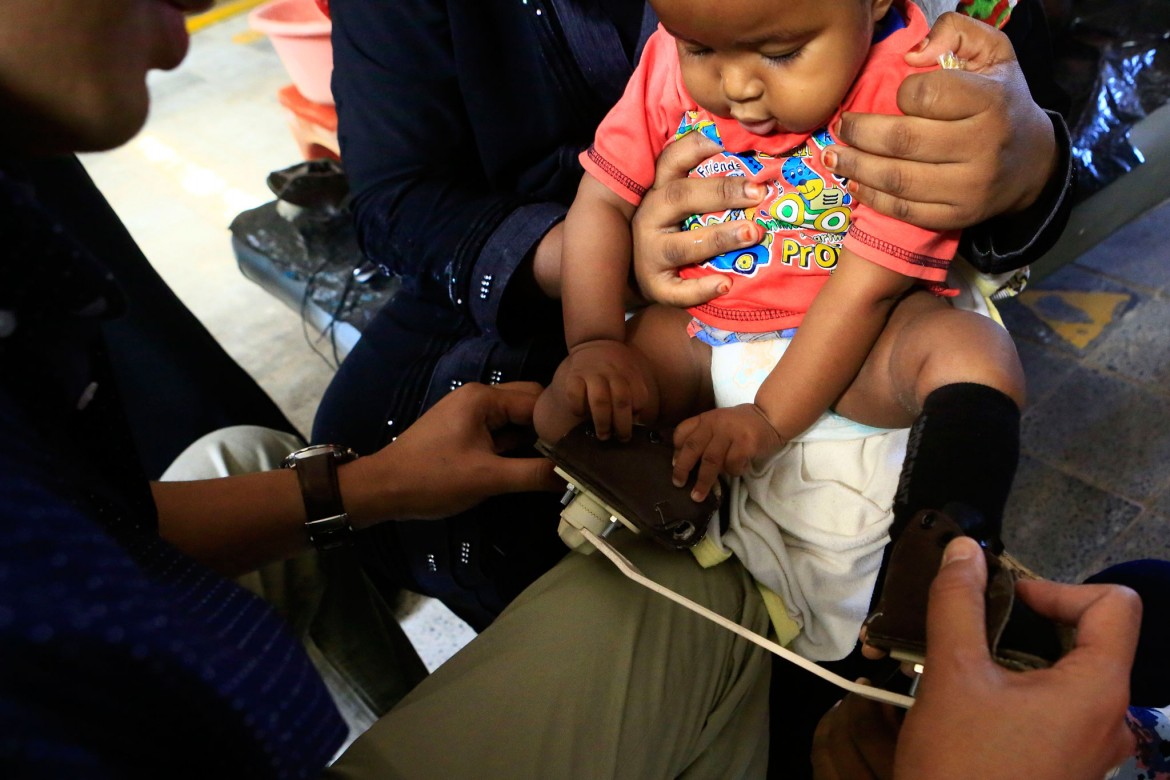 Soudan : soigner les bébés nés avec un pied bot | Comité international de  la Croix-Rouge