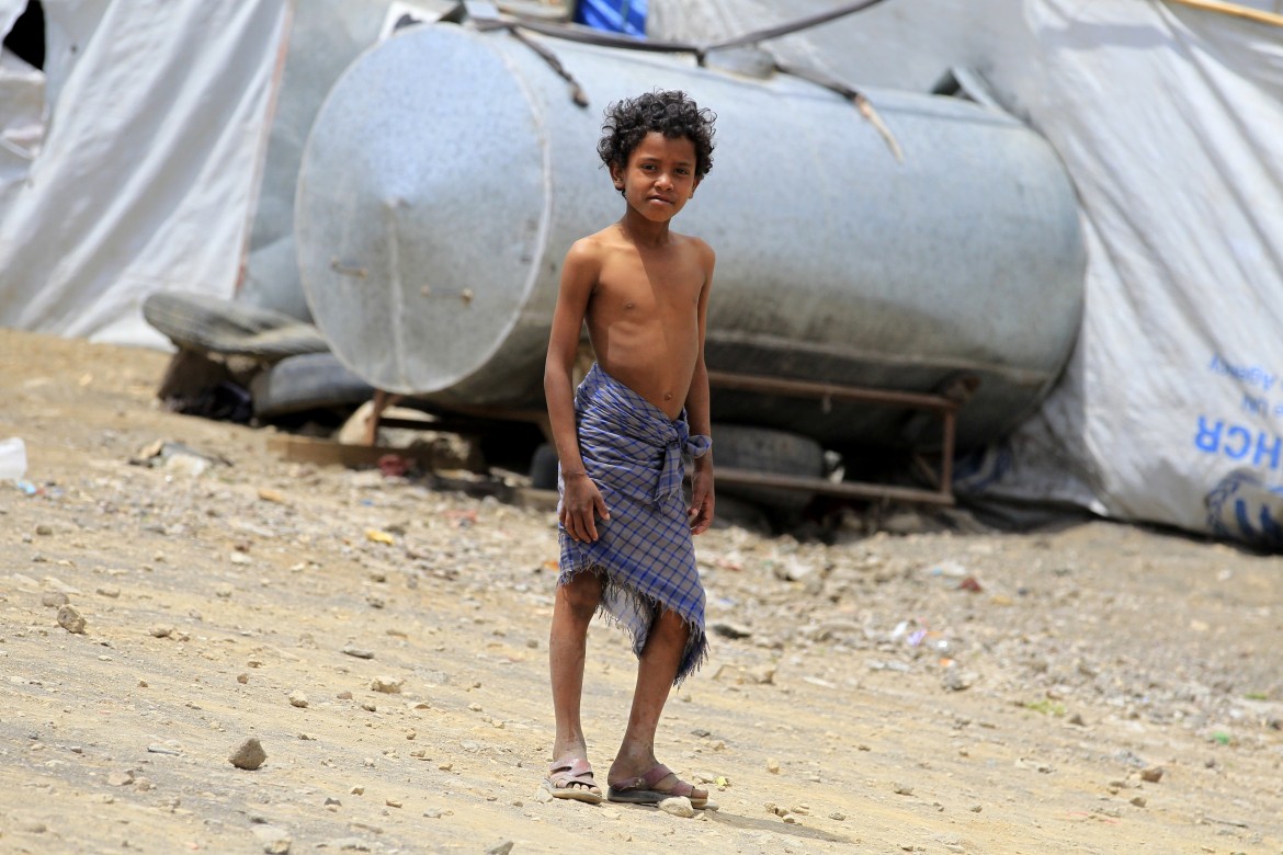 طفولة منقوصة: عواقب النزاع على أطفال اليمن | اللجنة الدولية للصليب الأحمر